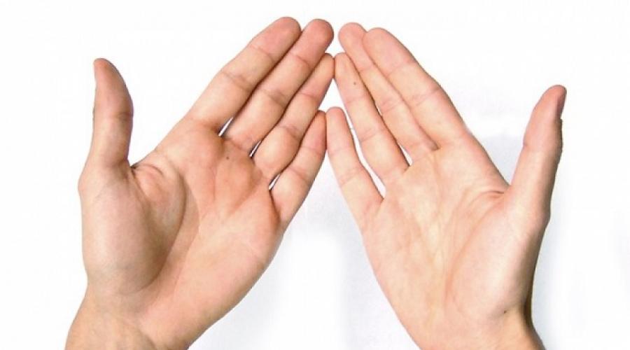 hiperhidrosis